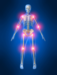 Dolor articulaciones, joint pain, dor articular, sindrome bi Dolor articulaciones, joint pain, dor articular, sindrome bi